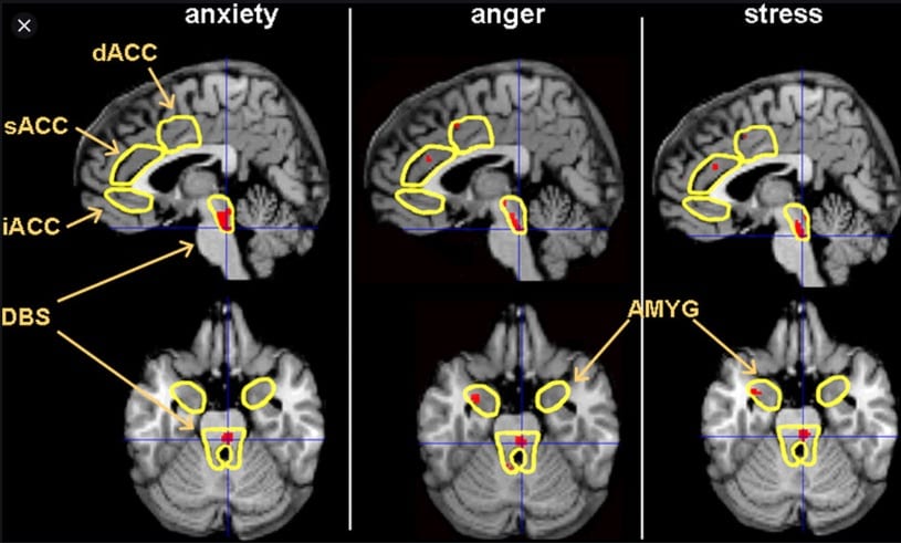 This Is What Brain Imaging Reveals About Anxiety   Depression   Motherhood Community - 41